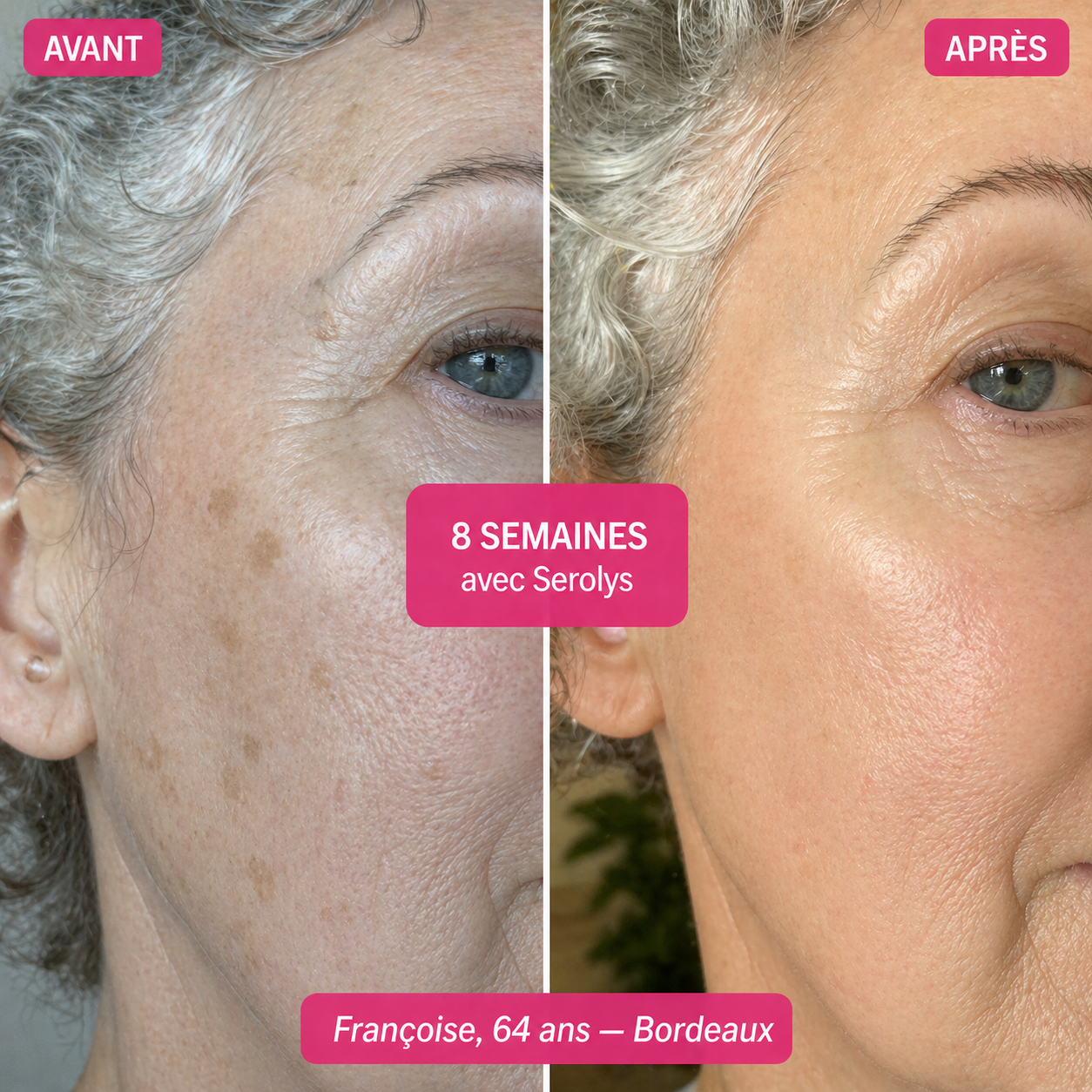 Sérum Super C Serolys