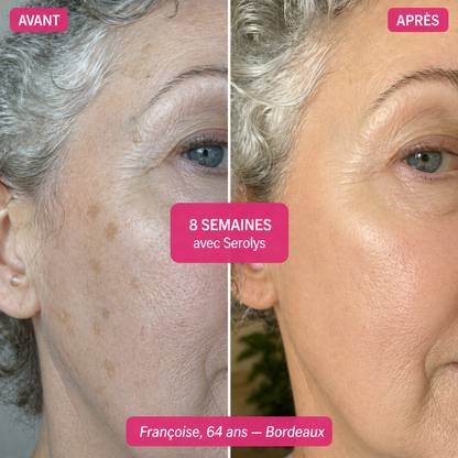 Sérum Super C Serolys