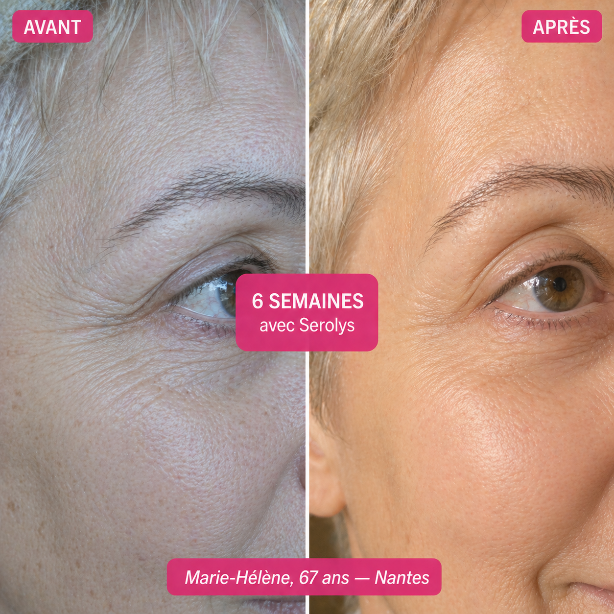 Sérum Super C Serolys